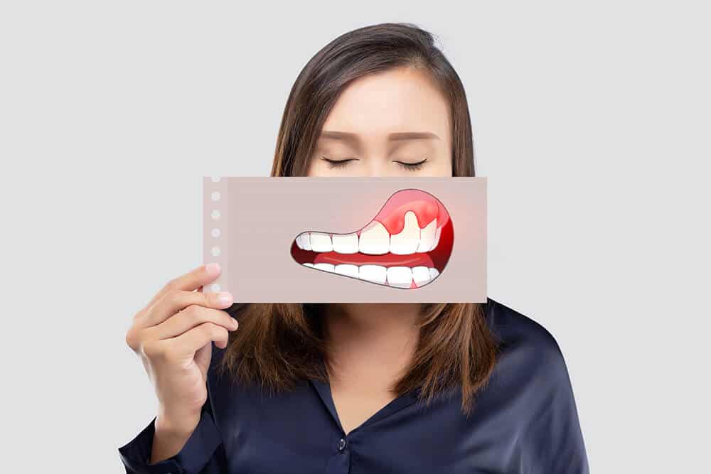 encías inflamadas causas síntomas