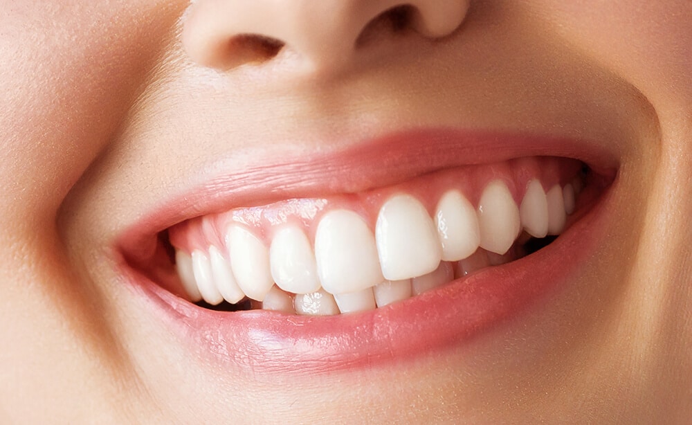 sonrisa gingival qué es