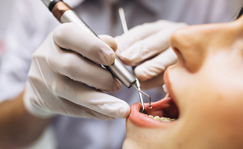 desvitalizar una muela endodoncia